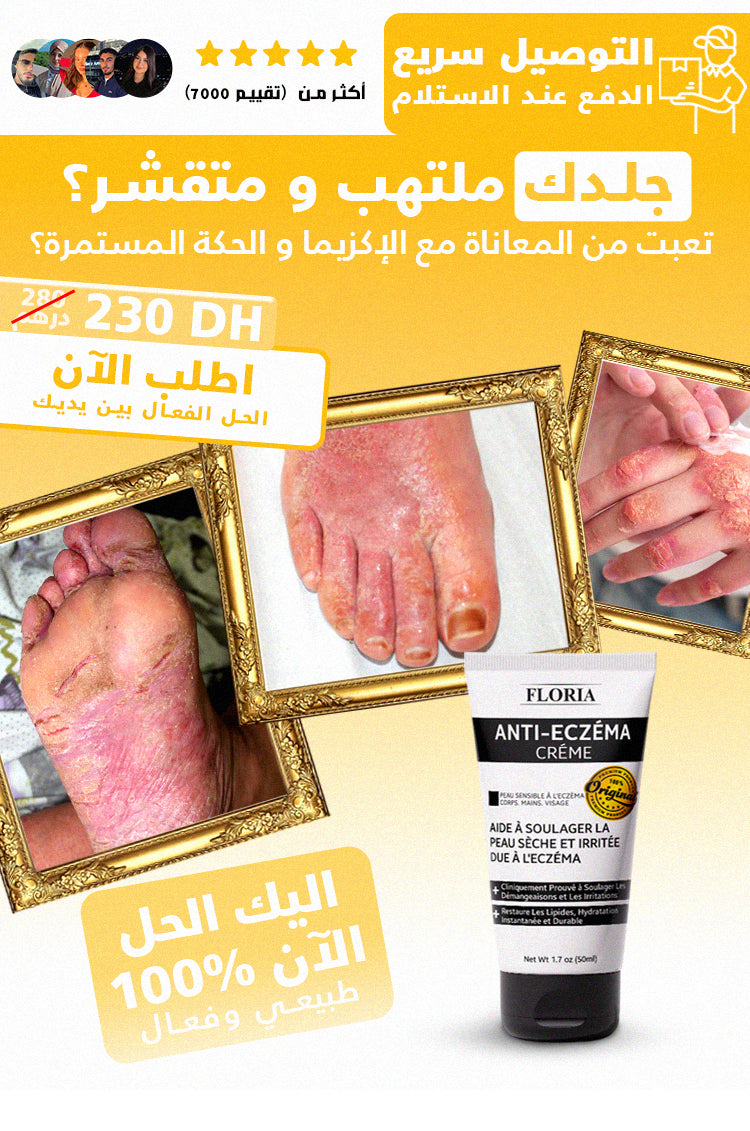 GAMME FLORIA كريم التخلص من الإكزيما