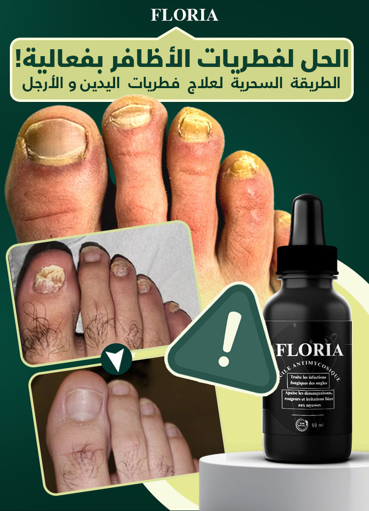 Gamme Floria للتخلص من فطريات الأظافر