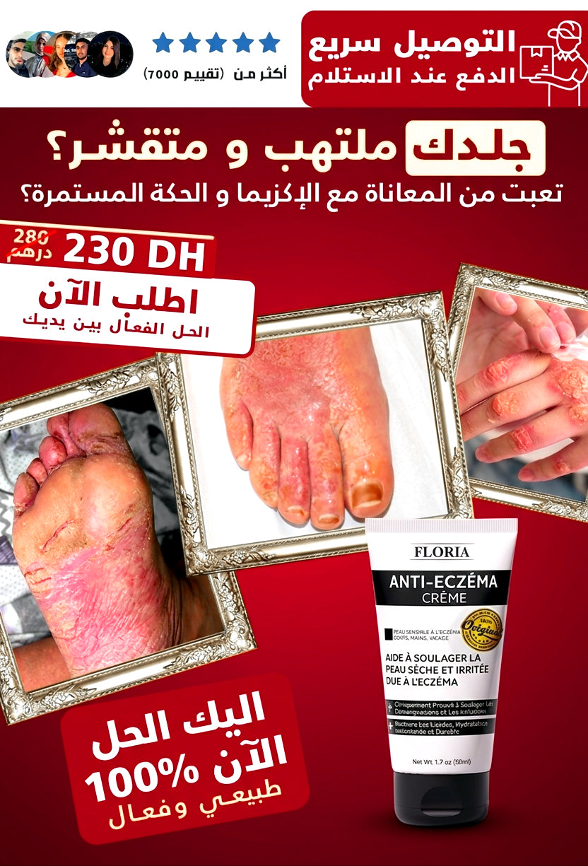 GAMME FLORIA كريم التخلص من الإكزيما